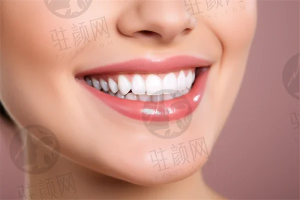 柳州鱼峰区全口牙齿种植医院十佳，柳州中瑞口腔医院在榜，第四名是当地出名靠谱的牙科