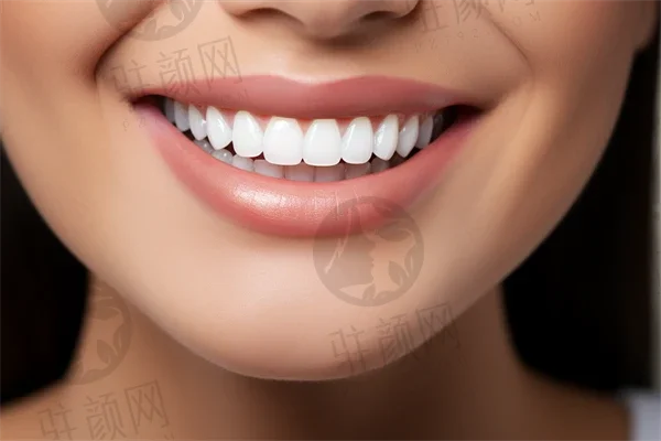 诺贝尔Active种植牙6342元一颗起；舌侧隐形牙齿矫正9072元起