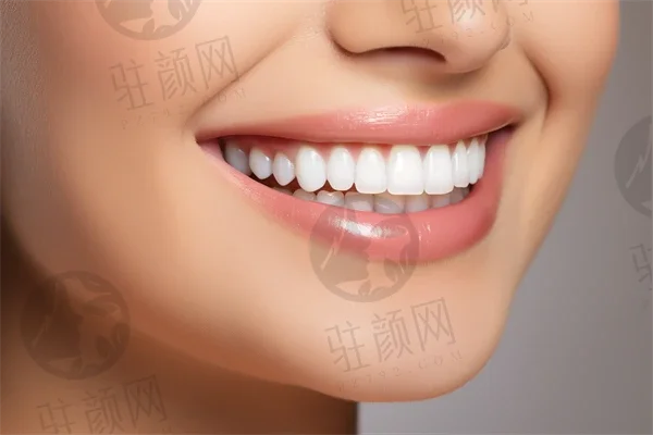 北京艾瑞特口腔诊所费用多少，韩国美格真种植牙7733元一颗起；骨性地包天正畸10303元起