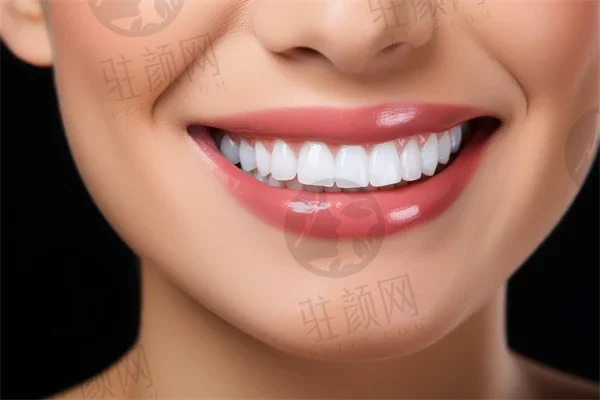 杭州多颗牙齿种植医院前十，杭州临安锦南口腔成为榜首，第八名技术稳定审美在线不踩坑！