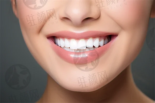 哈尔滨优范口腔门诊部价格明细，钛合金基台种植牙7361元一颗起；儿童牙齿矫正8854元起