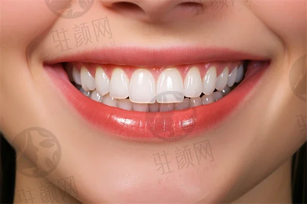 广州牙齿微创种植口腔医院榜单top10，广州雅至美口腔医院又是第一，第四名当属当地名气高