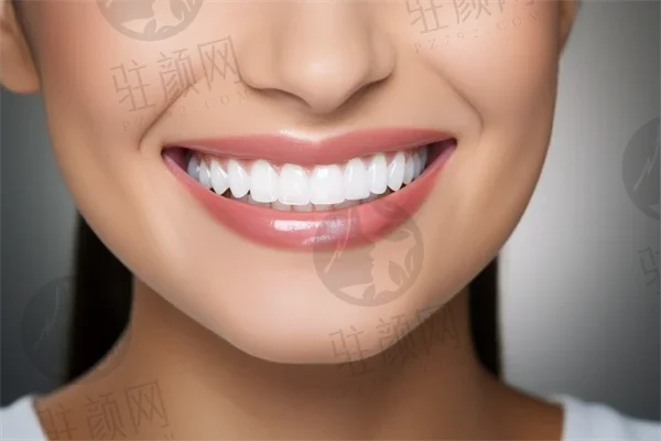 上海安缦口腔收费明细，国产威高种植牙种植牙7037元一颗起；牙齿错颌畸形矫正8661元起