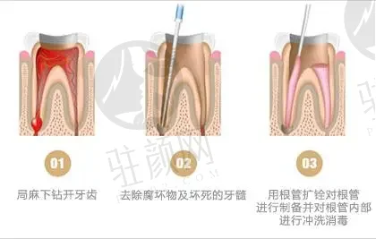 湖州口腔医院排名大揭秘！哪家好口碑超赞，优势拼比评价，你不能错过！