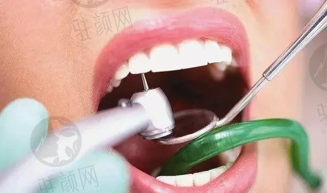 南宁牙精灵口腔