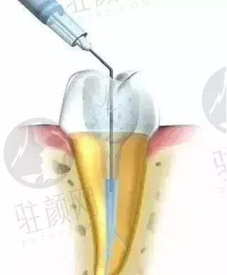 赣州穿颧种植牙医院