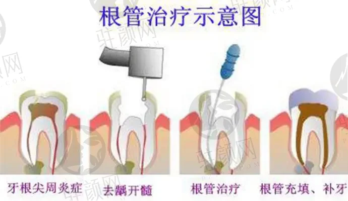 苏州工业园区一口好牙口腔诊所