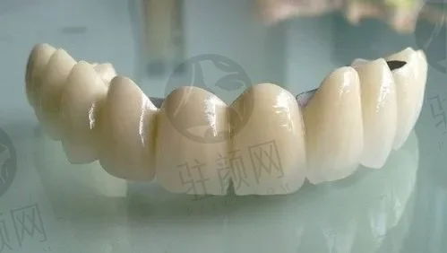 郑州正合口腔门诊部价目大全，高分子材质种植牙7394元一颗起；陶瓷牙套矫正11804元起