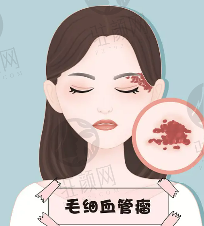 上海馥兰朵医疗美容眼部手术怎么样？费用价目表新公布了