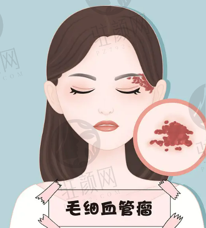 重庆华美美容医院做双眼皮怎么样?专家简介、价格表分享 重庆华美美容医院做双眼皮怎么样?专家简介、价格表分享