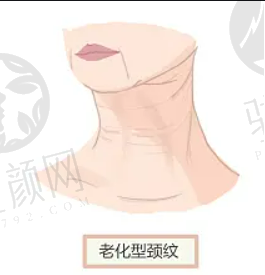 杭州连天美医疗美容医院评价如何？专家团队介绍｜附2024非常新价目表