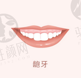 上海九院鼻修复要多少钱?实力医生介绍+案例分享+价目表 上海九院鼻修复要多少钱?实力医生介绍+案例分享+价目表