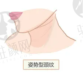 上海九院磨骨医生排名,杨娴娴、祝联、魏皎等上榜,附价格表 上海九院磨骨医生排名,杨娴娴、祝联、魏皎等上榜,附价格表