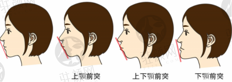 北京友谊医院眼部整形怎么样？专家医生介绍+案例分享+价格表