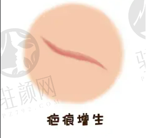 深圳艺星整形医院祛斑多少钱？价格表更新！医生简介附上