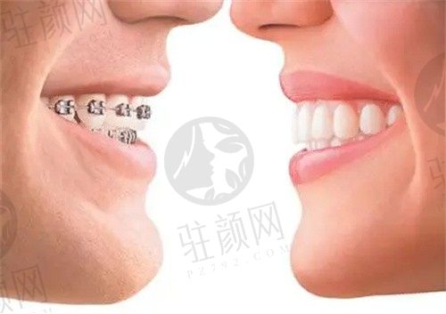 长沙美奥口腔医院陈荣花儿童早期矫正3800元起，改善儿童牙齿不齐效果很好的  