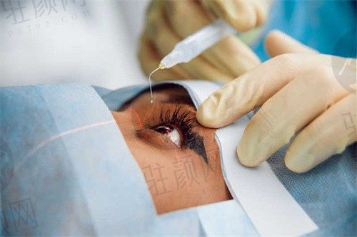 宣城康视眼科医院做半飞秒手术费用1.5w元，让您重获清晰视界