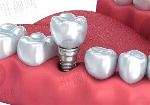 深圳爱康健口腔医院怎么样？地址电话预约价格一览，看看真实患者评价如何