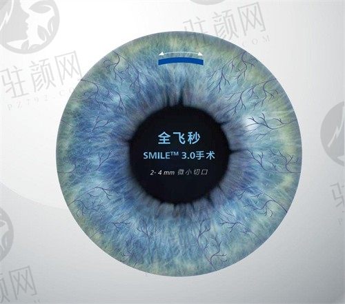 乌鲁木齐普瑞眼科医院蒋国安全飞秒手术价格18600元起，为您的清晰视界保驾护航