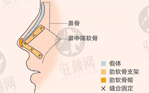 王艳鼻修复怎么样