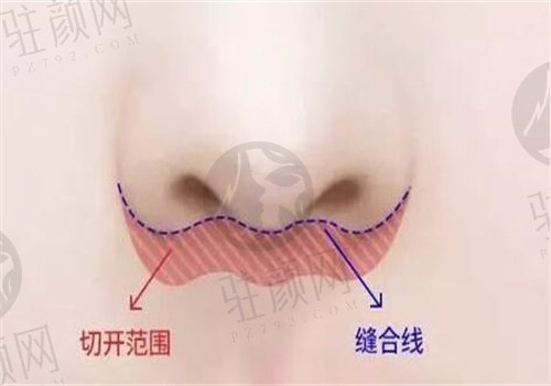 马群会个性化设计手术方案，精细化程度高