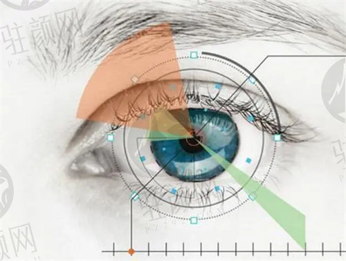 长春恒达眼科医院近视手术价格表