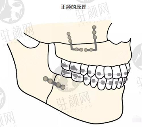 上海时光整形正颌手术价格