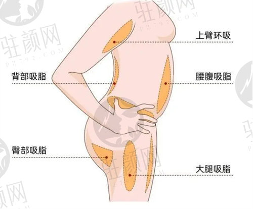 上海丽铂医疗美容吸脂价格