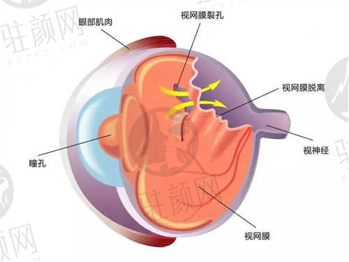 中山爱尔眼科医院预约方式.jpg