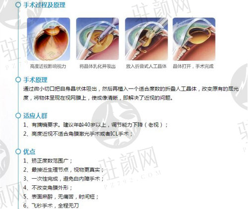 昆明普瑞眼科医院雷鸣白内障手术演示图