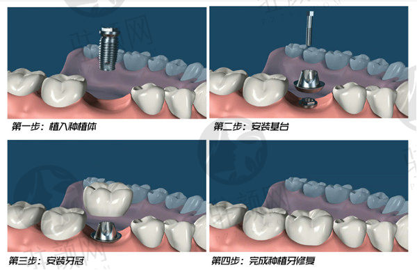 北京紫荆医院口腔科