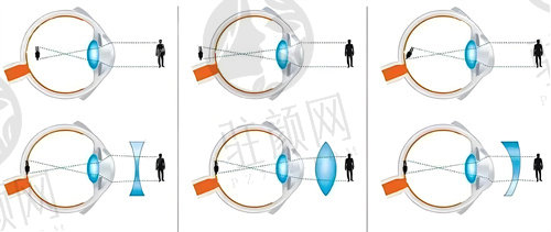 西安高新医院眼科门诊在几楼