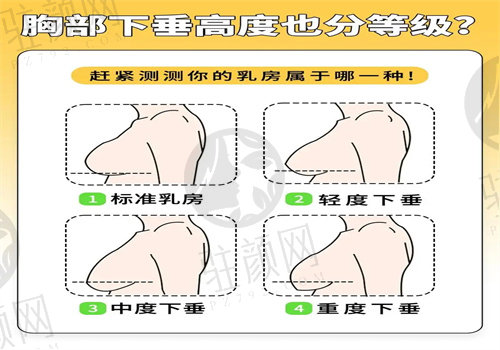 已经假体隆胸了但还是下垂咋办?