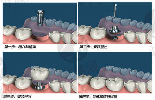 威海华海口腔医院口碑介绍