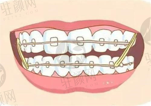 深圳鼎植口腔牙齿矫正怎么样