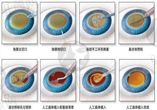 福州亮睛眼科医院就诊导航