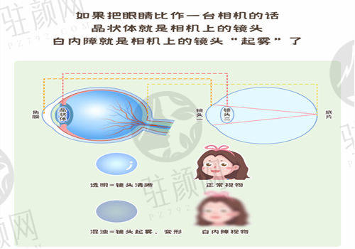 福州亮睛眼科医院怎么样？