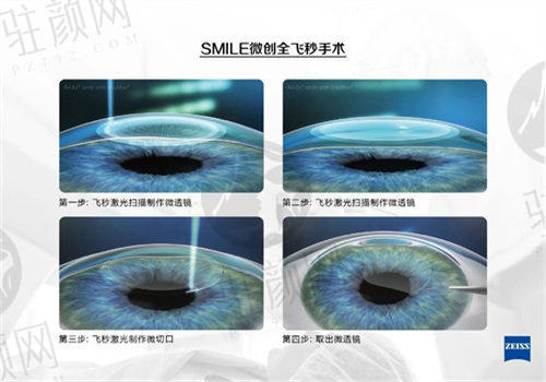 临汾洛基眼科医院的特色服务