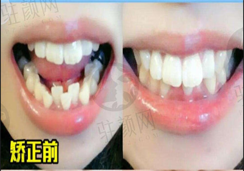 长沙辰星口腔门诊部牙齿矫正的优势和特色