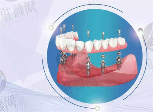 爱齿乐口腔门诊口碑评价