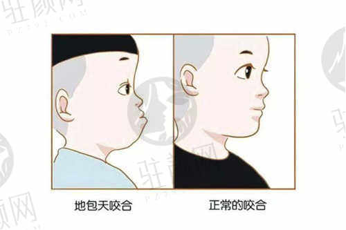 郑州美奥口腔医院ETA矫正技术怎么样好不好？（优势）