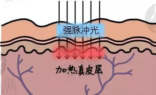 西宁韩美美容医院做光子嫩肤怎么样