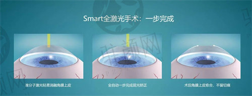 乌鲁木齐普瑞眼科医院做近视眼手术怎么样