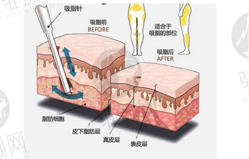 深圳鹏程医院怎么样