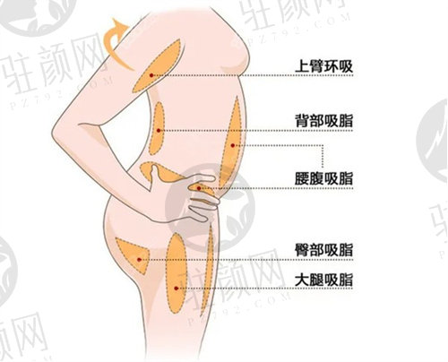 北京润美玉之光吸脂口碑好吗