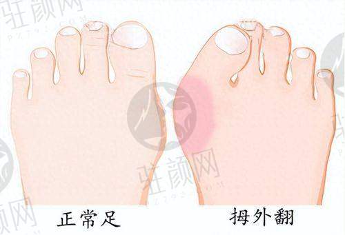 国内眼部整形排名前十医生之北京地区