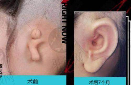 国内面部软组织重塑手术医院排名前十