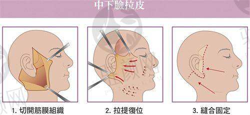杭州美莱医疗美容医院：科技吸脂先锋