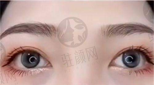 高亮：高难度眼修复能手