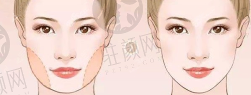 王阔远医生高难度修复经验多